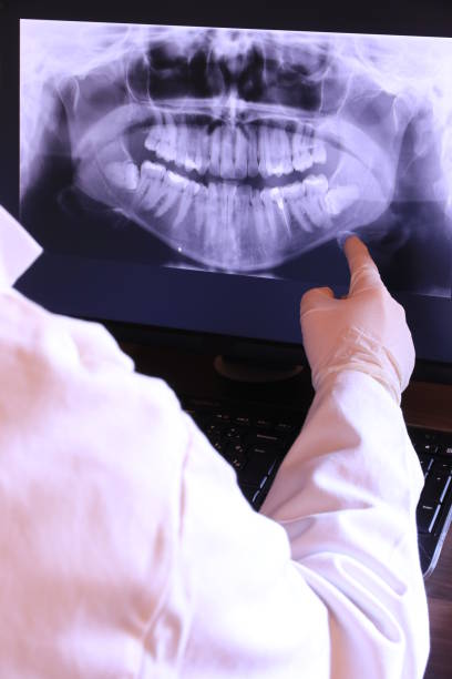 Best Emergency Dentist for Lost Fillings or Crowns in Fort Payne, AL